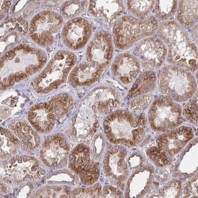Immunohistochemistry-Paraffin: TRAIL/TNFSF10 Antibody [NBP2-38744]