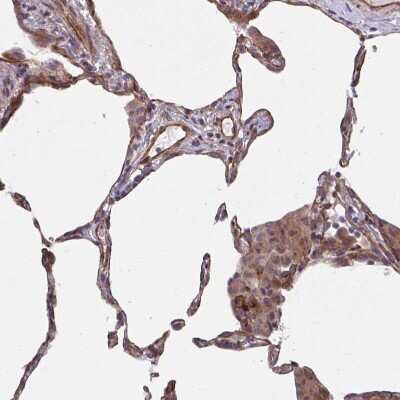 Immunohistochemistry-Paraffin: TRAIL/TNFSF10 Antibody [NBP2-38744]