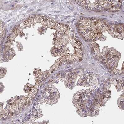 Immunohistochemistry-Paraffin: TRAIL/TNFSF10 Antibody [NBP2-38744]