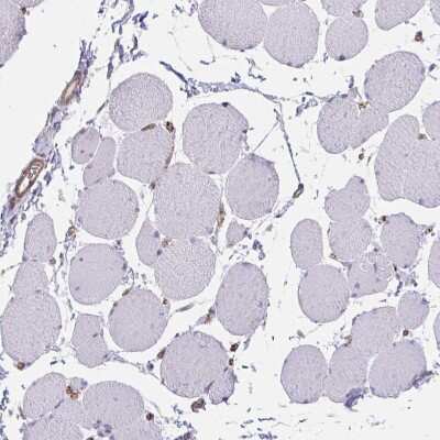Immunohistochemistry-Paraffin: TRAIL/TNFSF10 Antibody [NBP2-38744]