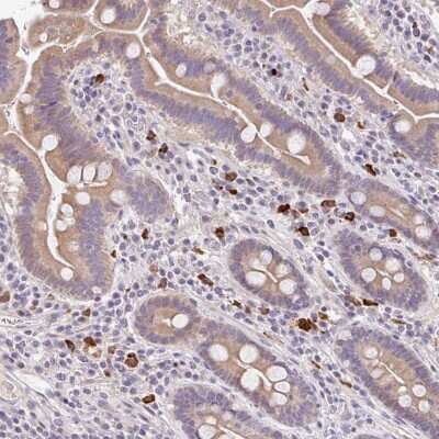 Immunohistochemistry-Paraffin: TRAILR1/TNFRSF10A Antibody [NBP2-33716]