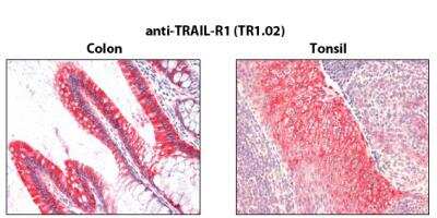 Immunohistochemistry-Paraffin: TRAILR1/TNFRSF10A Antibody (TR1.02) - BSA Free [NBP2-80069]