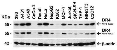 Western Blot: TRAILR1/TNFRSF10A AntibodyBSA Free [NBP2-25092]