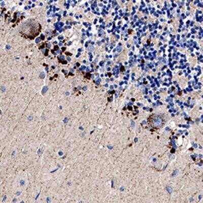 Immunohistochemistry-Paraffin: TRAILR2/TNFRSF10B Antibody - Azide Free [NB100-55744]