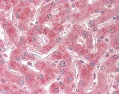 Immunohistochemistry: TRAILR2/TNFRSF10B Antibody (HS201) - Azide and BSA Free [NBP2-80067]