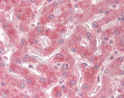 Immunohistochemistry-Paraffin: TRAILR2/TNFRSF10B Antibody (HS201) - BSA Free [NBP2-80066]