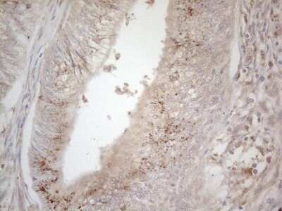 Immunohistochemistry: TRAILR2/TNFRSF10B Antibody (OTI2A5) - Azide and BSA Free [NBP2-74578]