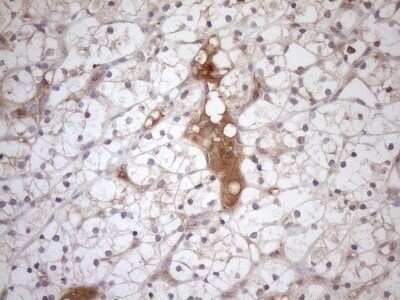 Immunohistochemistry: TRAILR2/TNFRSF10B Antibody (OTI2A5) - Azide and BSA Free [NBP2-74578]
