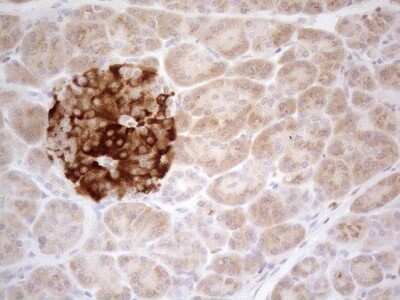 Immunohistochemistry: TRAILR2/TNFRSF10B Antibody (OTI2A5) - Azide and BSA Free [NBP2-74578]