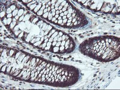 Immunohistochemistry-Paraffin: TRAIP Antibody (OTI2D4) [NBP2-03822]