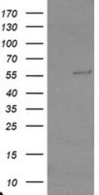 Western Blot: TRAIP Antibody (OTI2D4) [NBP2-03822]
