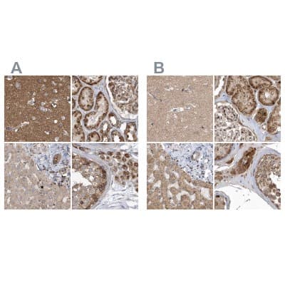Immunohistochemistry-Paraffin: TRAIP Antibody [NBP1-87125]