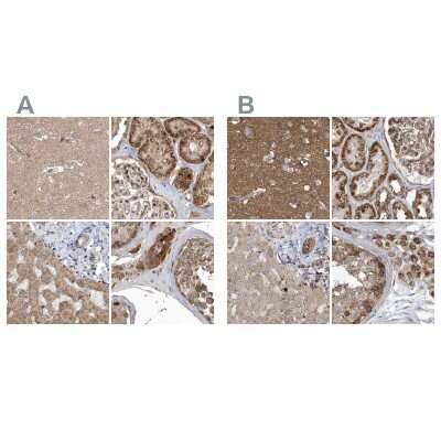 Immunohistochemistry-Paraffin: TRAIP Antibody [NBP2-48655]