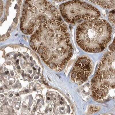 Immunohistochemistry-Paraffin: TRAIP Antibody [NBP2-48655]