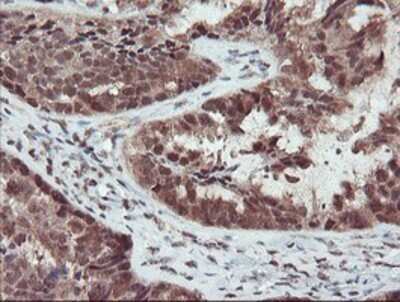 Immunohistochemistry: TRAIP Antibody (OTI2D4) - Azide and BSA Free [NBP2-74580]