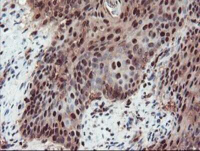 Immunohistochemistry: TRAIP Antibody (OTI2D4) - Azide and BSA Free [NBP2-74580]