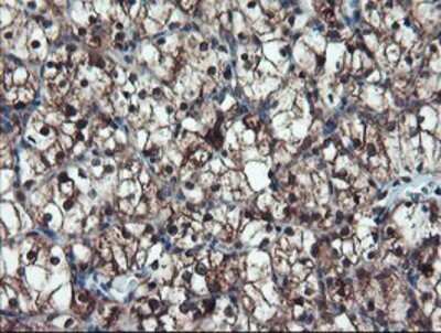 Immunohistochemistry: TRAIP Antibody (OTI2D4) - Azide and BSA Free [NBP2-74580]