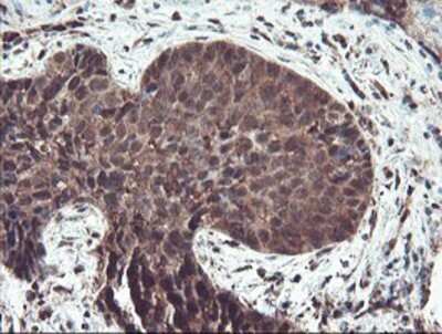 Immunohistochemistry: TRAIP Antibody (OTI2D4) - Azide and BSA Free [NBP2-74580]