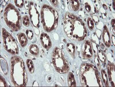 Immunohistochemistry: TRAIP Antibody (OTI2D4) - Azide and BSA Free [NBP2-74580]