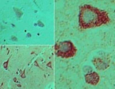 Immunohistochemistry-Paraffin: TRAM/TICAM2 Antibody [NBP2-24686]