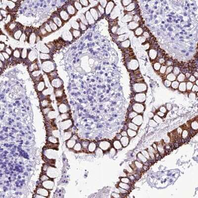 Immunohistochemistry-Paraffin: TRAM1L1 Antibody [NBP1-82727]