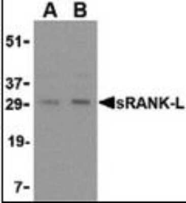 Western Blot: TRANCE/TNFSF11/RANK L AntibodyBSA Free [NB100-80849]