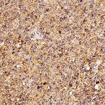 Immunohistochemistry: TRANCE/TNFSF11/RANK L Antibody (12A380) - Azide and BSA Free [NBP2-27402]
