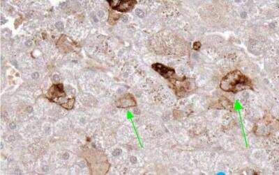 Immunohistochemistry-Paraffin: TRANCE/TNFSF11/RANK L Antibody (12A668) - Azide and BSA Free [NB100-56593]