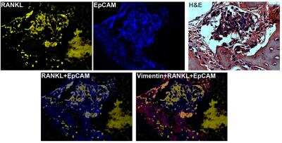 Immunohistochemistry: TRANCE/TNFSF11/RANK L Antibody (12A668) - BSA Free [NB100-56512]