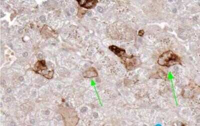 Immunohistochemistry-Paraffin: TRANCE/TNFSF11/RANK L Antibody (12A668) - BSA Free [NB100-56512]