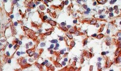 Immunohistochemistry-Paraffin: TRANCE/TNFSF11/RANK L Antibody (12A668) - BSA Free [NB100-56512]