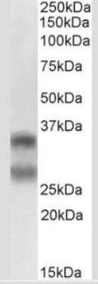 Western Blot: TRANCE/TNFSF11/RANK L Antibody (12A668)BSA Free [NB100-56512]