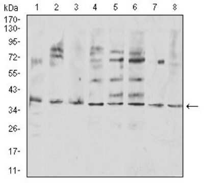 Western Blot: TRANCE/TNFSF11/RANK L Antibody (8A7B9)BSA Free [NBP2-61813]