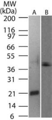 Western Blot: TRANCE/TNFSF11/RANK L Antibody [NB100-56392]