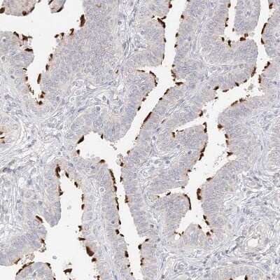 Immunohistochemistry-Paraffin: TRANK1 Antibody [NBP1-93641]