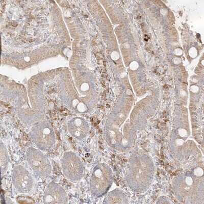 Immunohistochemistry-Paraffin: TRANK1 Antibody [NBP1-93641]