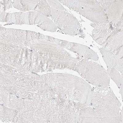 Immunohistochemistry-Paraffin: TRANK1 Antibody [NBP1-93641]