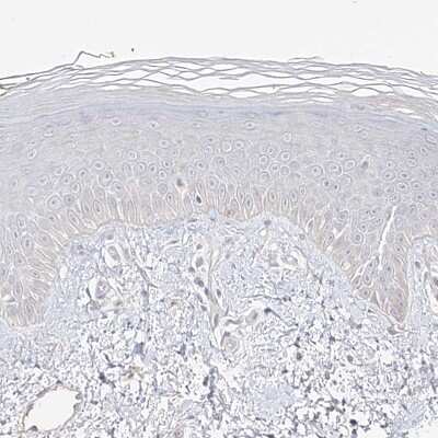 Immunohistochemistry-Paraffin: TRANK1 Antibody [NBP1-93641]