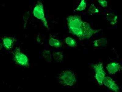 Immunocytochemistry/ Immunofluorescence: TRAP alpha Antibody (OTI4C7) [NBP2-01026]