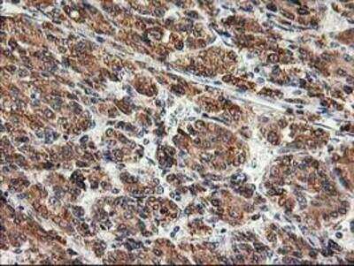 Immunohistochemistry-Paraffin: TRAP alpha Antibody (OTI4C7) [NBP2-01026]