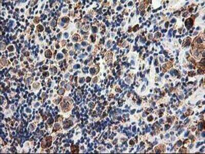 Immunohistochemistry-Paraffin: TRAP alpha Antibody (OTI4C7) [NBP2-01026]