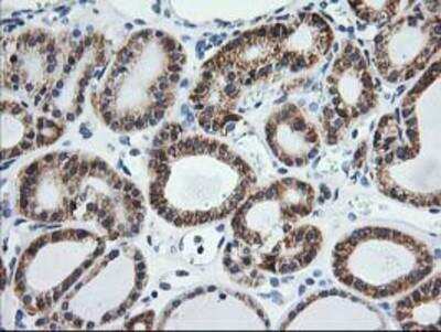 Immunohistochemistry-Paraffin: TRAP alpha Antibody (OTI4C7) [NBP2-01026]