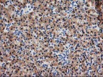 Immunohistochemistry-Paraffin: TRAP alpha Antibody (OTI4C7) [NBP2-01026]