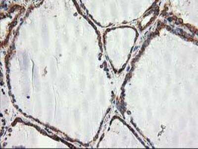Immunohistochemistry-Paraffin: TRAP alpha Antibody (OTI4C7) [NBP2-01026]
