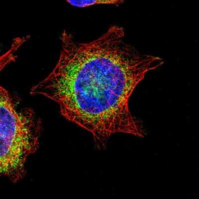 Immunocytochemistry/ Immunofluorescence: TRAP alpha Antibody [NBP1-86912]