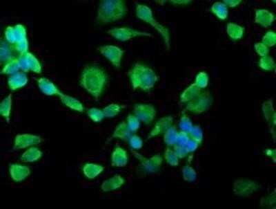 Immunocytochemistry/ Immunofluorescence: TRAP alpha Antibody (OTI4C7) - Azide and BSA Free [NBP2-74591]