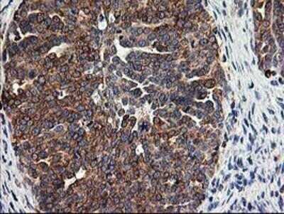 Immunohistochemistry: TRAP alpha Antibody (OTI4C7) - Azide and BSA Free [NBP2-74591]