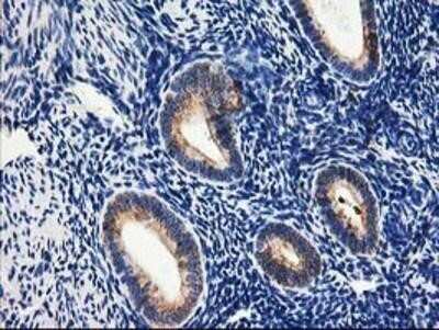 Immunohistochemistry: TRAP alpha Antibody (OTI4C7) - Azide and BSA Free [NBP2-74591]