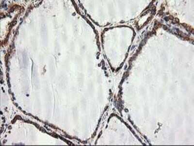 Immunohistochemistry: TRAP alpha Antibody (OTI4C7) - Azide and BSA Free [NBP2-74591]