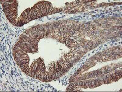 Immunohistochemistry-Paraffin: TRAP1 Antibody (OTI1H8) [NBP2-01707]